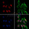 DF3142 at 1/100 staining Human lung tissue by IHC-P. The sample was formaldehyde fixed and a heat mediated antigen retrieval step in citrate buffer was performed. The sample was then blocked and incubated with the antibody for 1.5 hours at 22¡ãC. An HRP conjugated goat anti-rabbit antibody was used as the secondary