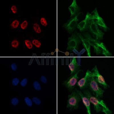 DF3142 at 1/100 staining Human lung tissue by IHC-P. The sample was formaldehyde fixed and a heat mediated antigen retrieval step in citrate buffer was performed. The sample was then blocked and incubated with the antibody for 1.5 hours at 22¡ãC. An HRP conjugated goat anti-rabbit antibody was used as the secondary