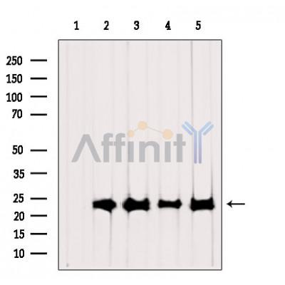 Western blot analysis of extracts from various samples, using RPL19 Antibody.
 Lane 1: Rat  brain, treated with blocking peptide;
 Lane 2: Rat  brain;
 Lane 3: Hybridoma cells;
 Lane 4: Mouse  lung;
 Lane 5: 293.