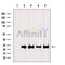 Western blot analysis of extracts from various samples, using RPL19 Antibody.
 Lane 1: Rat  brain, treated with blocking peptide;
 Lane 2: Rat  brain;
 Lane 3: Hybridoma cells;
 Lane 4: Mouse  lung;
 Lane 5: 293.