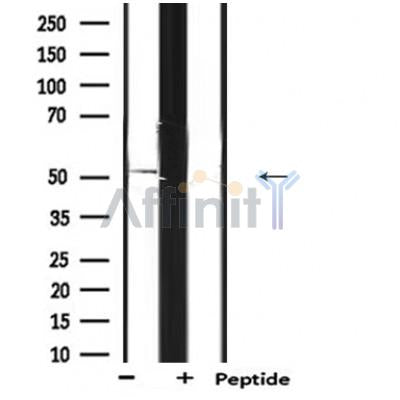 Western blot analysis of extracts from Mouse liver, using ANGPTL3 Antibody. The lane on the right was treated with blocking peptide.
