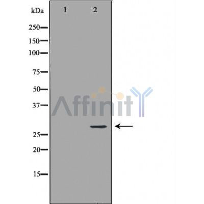 DF6186 at 1/100 staining Mouse heart tissue by IHC-P. The sample was formaldehyde fixed and a heat mediated antigen retrieval step in citrate buffer was performed. The sample was then blocked and incubated with the antibody for 1.5 hours at 22¡ãC. An HRP conjugated goat anti-rabbit antibody was used as the secondary