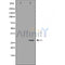 DF6186 at 1/100 staining Mouse heart tissue by IHC-P. The sample was formaldehyde fixed and a heat mediated antigen retrieval step in citrate buffer was performed. The sample was then blocked and incubated with the antibody for 1.5 hours at 22¡ãC. An HRP conjugated goat anti-rabbit antibody was used as the secondary