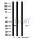 DF6194 at 1/100 staining Human Melanoma tissue by IHC-P. The sample was formaldehyde fixed and a heat mediated antigen retrieval step in citrate buffer was performed. The sample was then blocked and incubated with the antibody for 1.5 hours at 22¡ãC. An HRP conjugated goat anti-rabbit antibody was used as the secondary