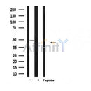 DF6209 at 1/100 staining Human prostate tissue by IHC-P. The sample was formaldehyde fixed and a heat mediated antigen retrieval step in citrate buffer was performed. The sample was then blocked and incubated with the antibody for 1.5 hours at 22¡ãC. An HRP conjugated goat anti-rabbit antibody was used as the secondary