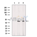DF6291 at 1/100 staining Mouse muscle tissue by IHC-P. The sample was formaldehyde fixed and a heat mediated antigen retrieval step in citrate buffer was performed. The sample was then blocked and incubated with the antibody for 1.5 hours at 22¡ãC. An HRP conjugated goat anti-rabbit antibody was used as the secondary