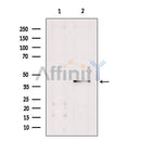 DF6441 at 1/100 staining Rat lung tissue by IHC-P. The sample was formaldehyde fixed and a heat mediated antigen retrieval step in citrate buffer was performed. The sample was then blocked and incubated with the antibody for 1.5 hours at 22¡ãC. An HRP conjugated goat anti-rabbit antibody was used as the secondary
