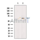 DF6474 at 1/100 staining Mouse liver tissue by IHC-P. The sample was formaldehyde fixed and a heat mediated antigen retrieval step in citrate buffer was performed. The sample was then blocked and incubated with the antibody for 1.5 hours at 22¡ãC. An HRP conjugated goat anti-rabbit antibody was used as the secondary
