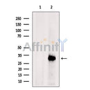 DF6499 at 1/100 staining Human gastric tissue by IHC-P. The sample was formaldehyde fixed and a heat mediated antigen retrieval step in citrate buffer was performed. The sample was then blocked and incubated with the antibody for 1.5 hours at 22¡ãC. An HRP conjugated goat anti-rabbit antibody was used as the secondary