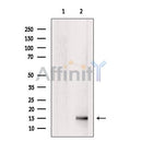 DF6508 at 1/100 staining Mouse testis tissue by IHC-P. The sample was formaldehyde fixed and a heat mediated antigen retrieval step in citrate buffer was performed. The sample was then blocked and incubated with the antibody for 1.5 hours at 22¡ãC. An HRP conjugated goat anti-rabbit antibody was used as the secondary