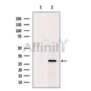 DF6529 at 1/100 staining Mouse brain tissue by IHC-P. The sample was formaldehyde fixed and a heat mediated antigen retrieval step in citrate buffer was performed. The sample was then blocked and incubated with the antibody for 1.5 hours at 22¡ãC. An HRP conjugated goat anti-rabbit antibody was used as the secondary