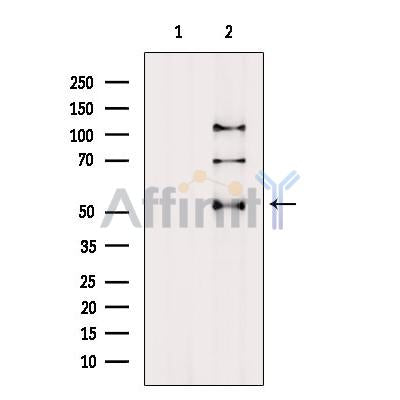 DF6684 at 1/100 staining Mouse testis tissue by IHC-P. The sample was formaldehyde fixed and a heat mediated antigen retrieval step in citrate buffer was performed. The sample was then blocked and incubated with the antibody for 1.5 hours at 22¡ãC. An HRP conjugated goat anti-rabbit antibody was used as the secondary