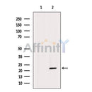 Western blot analysis of extracts from Rat  heart, using GPX4 Antibody. The lane on the left was treated with blocking peptide.