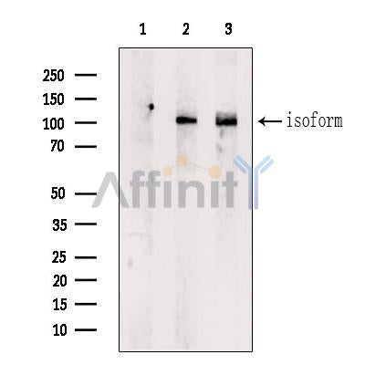 DF6752 at 1/100 staining Human lung tissue by IHC-P. The sample was formaldehyde fixed and a heat mediated antigen retrieval step in citrate buffer was performed. The sample was then blocked and incubated with the antibody for 1.5 hours at 22¡ãC. An HRP conjugated goat anti-rabbit antibody was used as the secondary