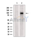 DF6920 at 1/100 staining Mouse liver tissue by IHC-P. The sample was formaldehyde fixed and a heat mediated antigen retrieval step in citrate buffer was performed. The sample was then blocked and incubated with the antibody for 1.5 hours at 22¡ãC. An HRP conjugated goat anti-rabbit antibody was used as the secondary