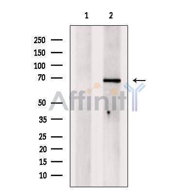 DF7015 at 1/100 staining Mouse liver tissue by IHC-P. The sample was formaldehyde fixed and a heat mediated antigen retrieval step in citrate buffer was performed. The sample was then blocked and incubated with the antibody for 1.5 hours at 22¡ãC. An HRP conjugated goat anti-rabbit antibody was used as the secondary