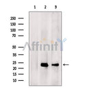 DF7017 at 1/100 staining Mouse liver tissue by IHC-P. The sample was formaldehyde fixed and a heat mediated antigen retrieval step in citrate buffer was performed. The sample was then blocked and incubated with the antibody for 1.5 hours at 22¡ãC. An HRP conjugated goat anti-rabbit antibody was used as the secondary