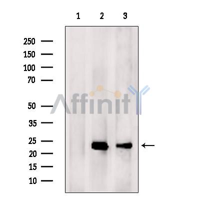 DF7017 at 1/100 staining Mouse liver tissue by IHC-P. The sample was formaldehyde fixed and a heat mediated antigen retrieval step in citrate buffer was performed. The sample was then blocked and incubated with the antibody for 1.5 hours at 22¡ãC. An HRP conjugated goat anti-rabbit antibody was used as the secondary