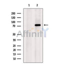Western blot analysis of extracts from Hela, using SDHA Antibody. The lane on the left was treated with blocking peptide.