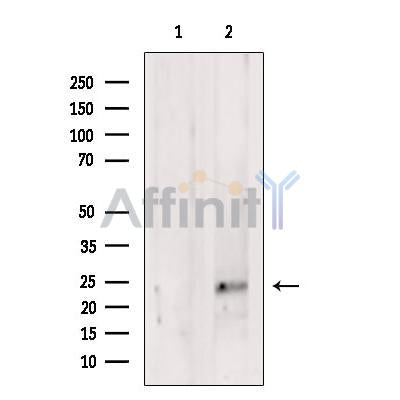 DF7077 at 1/100 staining Mouse heart tissue by IHC-P. The sample was formaldehyde fixed and a heat mediated antigen retrieval step in citrate buffer was performed. The sample was then blocked and incubated with the antibody for 1.5 hours at 22¡ãC. An HRP conjugated goat anti-rabbit antibody was used as the secondary