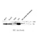 Western blot  analysis of extrats from various samples.