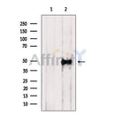 DF7097 at 1/100 staining Mouse testis tissue by IHC-P. The sample was formaldehyde fixed and a heat mediated antigen retrieval step in citrate buffer was performed. The sample was then blocked and incubated with the antibody for 1.5 hours at 22¡ãC. An HRP conjugated goat anti-rabbit antibody was used as the secondary