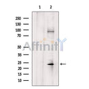 DF7198 at 1/100 staining Rat brain tissue by IHC-P. The sample was formaldehyde fixed and a heat mediated antigen retrieval step in citrate buffer was performed. The sample was then blocked and incubated with the antibody for 1.5 hours at 22¡ãC. An HRP conjugated goat anti-rabbit antibody was used as the secondary