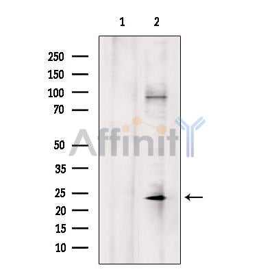 DF7198 at 1/100 staining Rat brain tissue by IHC-P. The sample was formaldehyde fixed and a heat mediated antigen retrieval step in citrate buffer was performed. The sample was then blocked and incubated with the antibody for 1.5 hours at 22¡ãC. An HRP conjugated goat anti-rabbit antibody was used as the secondary