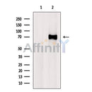DF7453 at 1/100 staining Rat brain tissue by IHC-P. The sample was formaldehyde fixed and a heat mediated antigen retrieval step in citrate buffer was performed. The sample was then blocked and incubated with the antibody for 1.5 hours at 22¡ãC. An HRP conjugated goat anti-rabbit antibody was used as the secondary