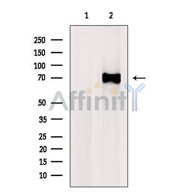 DF7453 at 1/100 staining Rat brain tissue by IHC-P. The sample was formaldehyde fixed and a heat mediated antigen retrieval step in citrate buffer was performed. The sample was then blocked and incubated with the antibody for 1.5 hours at 22¡ãC. An HRP conjugated goat anti-rabbit antibody was used as the secondary