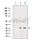 Western blot analysis of MT-CO2 using Jurkat whole  lysates.