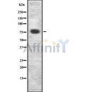 Western blot analysis of extracts from MCF7, using CRTC3 Antibody. The lane on the left was treated with blocking peptide.