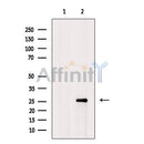 DF7893 staining HepG2 by IF/ICC. The sample were fixed with PFA and permeabilized in 0.1% Triton X-100,then blocked in 10% serum for 45 minutes at 25¡ãC. The primary antibody was diluted at 1/200 and incubated with the sample for 1 hour at 37¡ãC. An  Alexa Fluor 594 conjugated goat anti-rabbit IgG (H+L) Ab, diluted at 1/600, was used as the secondary antibod
