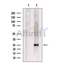 Western blot analysis of CEND1 using Jurkat whole  lysates.