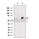 DF7948 at 1/100 staining RAT testis tissue by IHC-P. The sample was formaldehyde fixed and a heat mediated antigen retrieval step in citrate buffer was performed. The sample was then blocked and incubated with the antibody for 1.5 hours at 22¡ãC. An HRP conjugated goat anti-rabbit antibody was used as the secondary