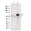 Western blot analysis FTO using Jurkat whole cell lysates