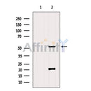 DF8547 at 1/100 staining Rat kidney tissue by IHC-P. The sample was formaldehyde fixed and a heat mediated antigen retrieval step in citrate buffer was performed. The sample was then blocked and incubated with the antibody for 1.5 hours at 22¡ãC. An HRP conjugated goat anti-rabbit antibody was used as the secondary
