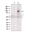 DF8609 at 1/100 staining Mouse kidney tissue by IHC-P. The sample was formaldehyde fixed and a heat mediated antigen retrieval step in citrate buffer was performed. The sample was then blocked and incubated with the antibody for 1.5 hours at 22¡ãC. An HRP conjugated goat anti-rabbit antibody was used as the secondary