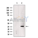 DF8731 staining  COLO205 cells by IF/ICC. The sample were fixed with PFA and permeabilized in 0.1% Triton X-100,then blocked in 10% serum for 45 minutes at 25¡ãC. The primary antibody was diluted at 1/200 and incubated with the sample for 1 hour at 37¡ãC. An  Alexa Fluor 594 conjugated goat anti-rabbit IgG (H+L) antibody(Cat.