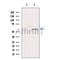 Western blot analysis of TPH2 using MCF7 whole cell lysates