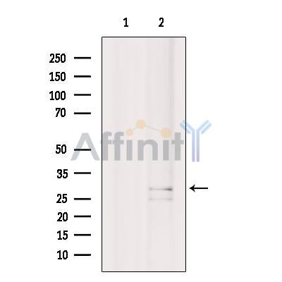 Western blot analysis of CD320 using HuvEc whole cell lysates