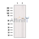 Western blot analysis of Cytochrome P450 46A1 using HuvEc whole cell lysates
