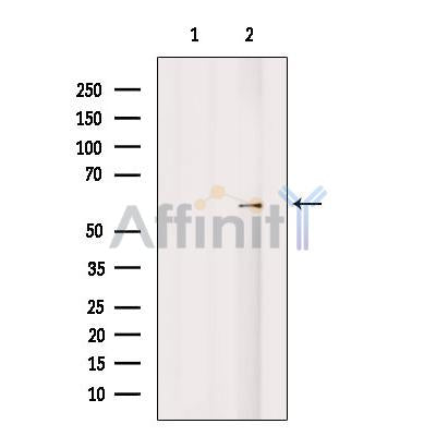 Western blot analysis of Cytochrome P450 46A1 using HuvEc whole cell lysates
