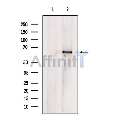 DF9184 staining LOVO by IF/ICC. The sample were fixed with PFA and permeabilized in 0.1% Triton X-100,then blocked in 10% serum for 45 minutes at 25¡ãC. The primary antibody was diluted at 1/200 and incubated with the sample for 1 hour at 37¡ãC. An  Alexa Fluor 594 conjugated goat anti-rabbit IgG (H+L) Ab, diluted at 1/600, was used as the secondary antibod
