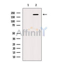 Western blot analysis of CAMTA1 using K562 whole cell lysates