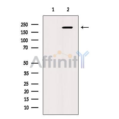 Western blot analysis of CAMTA1 using K562 whole cell lysates
