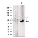 Western blot analysis of KIR2DL5A using K562 whole cell lysates