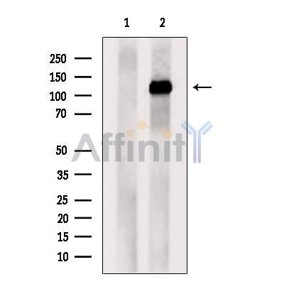 Western blot analysis NUP133 using LOVO whole cell lysates