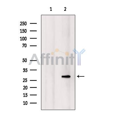 DF9720 at 1/100 staining Mouse muscle tissue by IHC-P. The sample was formaldehyde fixed and a heat mediated antigen retrieval step in citrate buffer was performed. The sample was then blocked and incubated with the antibody for 1.5 hours at 22¡ãC. An HRP conjugated goat anti-rabbit antibody was used as the secondary