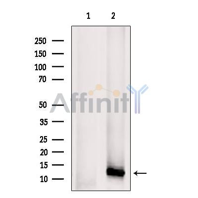 Western blot analysis of CXCL5 using RAW264.7 whole cell lysates